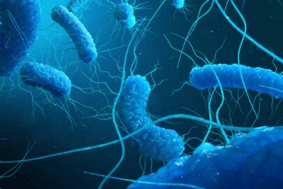 formación legionella